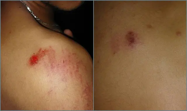 تعنيف واعتقال 18 محتجا ضد أزمة العطش بزاكورة (فيديو)