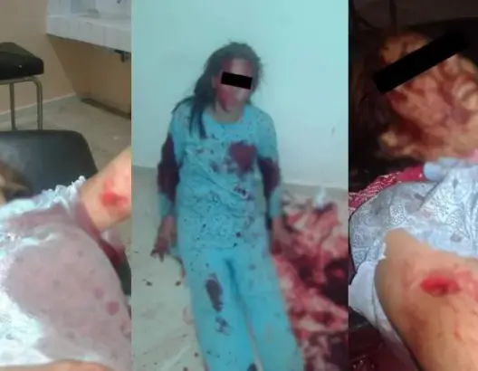 اعتقال شاب “شرمل” فتاة قاصر رفضت الزواج منه بسطات