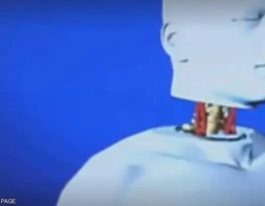 تغيير كبير في أول عملية زراعة رأس بالعالم