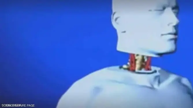 تغيير كبير في أول عملية زراعة رأس بالعالم