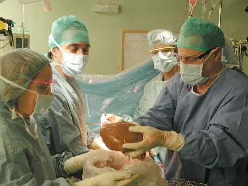 إطلاق حملة لدعوة المغاربة إلى التبرع بالأعضاء