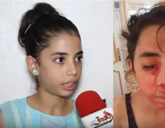 آية المصابة بمرض نادر: حلمي أن أعالج وأصبح طبيبة أسنان (فيديو)