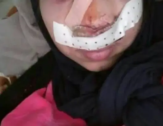 بعد واقعة أستاذ ورزازات .. مجهولون يهشمون أنف أستاذة بتيزنيت