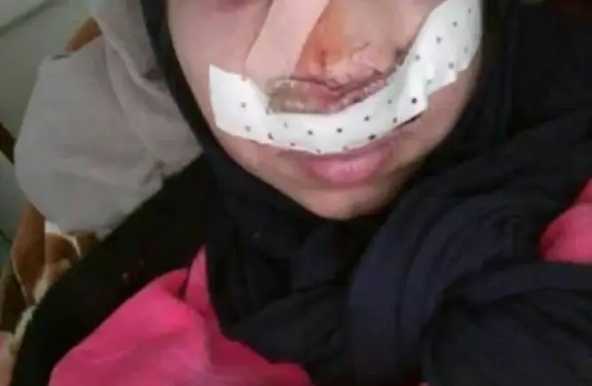 بعد واقعة أستاذ ورزازات .. مجهولون يهشمون أنف أستاذة بتيزنيت
