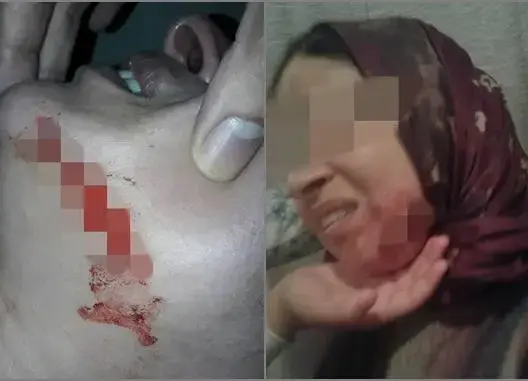 مصدر يكشف تفاصيل مثيرة حول اعتداء تلميذ على أستاذته بسكين بالبيضاء