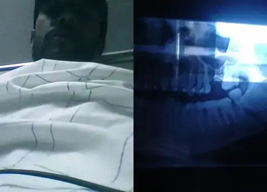 “طلبة صحراويون” يعتدون بالضرب على شاب ويكسرون فكه بأكادير