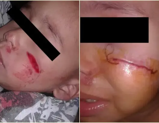 خطير.. اعتداء شنيع على طفل في ربيعه الثاني بدوار الحاجة بالرباط