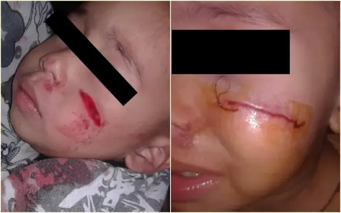 خطير.. اعتداء شنيع على طفل في ربيعه الثاني بدوار الحاجة بالرباط