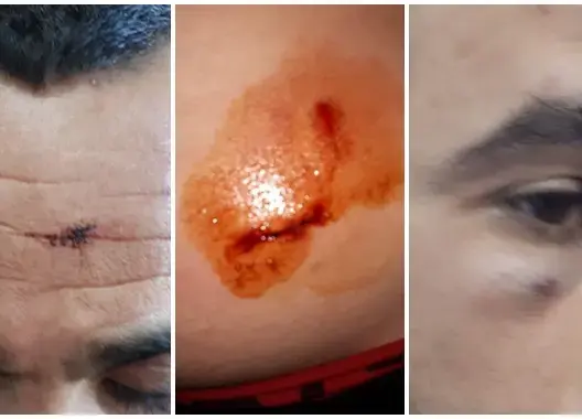 عصابات تستعين بكلب مفترس لمهاجمة مراقبي حافلات بالقنيطرة 