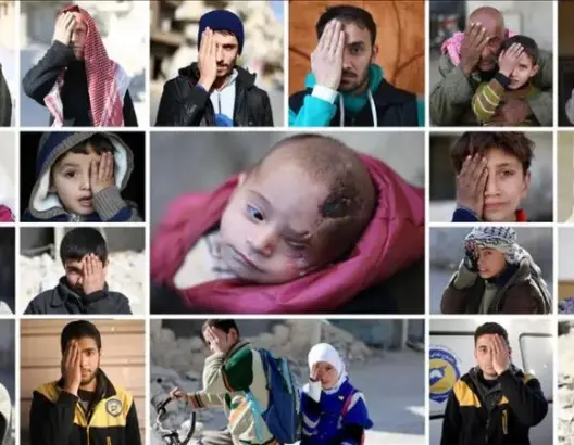 بعدما هشَّم النظام السوري رأسه.. موجة تضامن عالمية مع الرضيع “كريم” (صور)