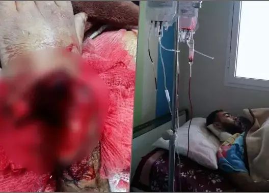 خطير: مجرم يقطع يد طالب بأزمور .. والجاني حر طليق منذ أسبوع