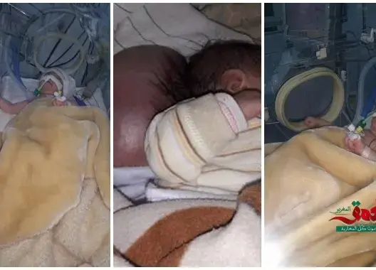 بعد خضوعها لعملية جراحية.. والد الطفلة ملاك يكشف آخر التطورات