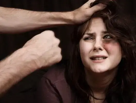 زوج يعذب زوجته بمساعدة أسرته بطريقة “بشعة” بكلميم (صور)