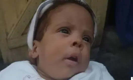 مستشفى دولة إفريقية يحتجز رضيعة 5 أشهر لعدم دفع والديها الفاتورة
