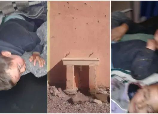 سقوط حوض صنبور يرسل طفلين في حالة حرجة لمستشفى ورزازات (صور)