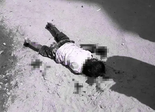 وفاة أحد ضحايا هجوم كلب مسعور نواحي زاكورة