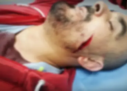 عصابة تعترض سبيل شاب بفاس و”تشرمله”.. والأمن يبحث عن الجناة (صورة)