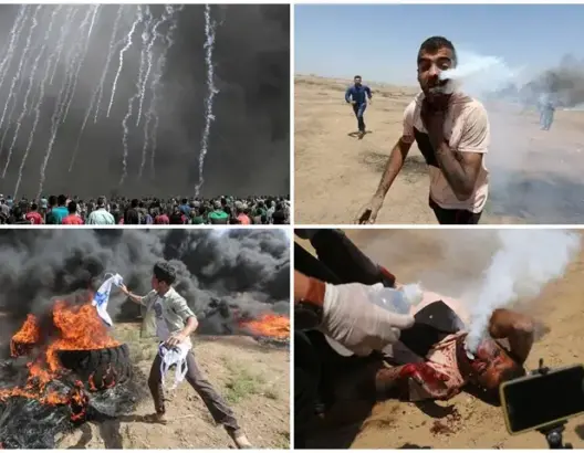 4 شهداء بغزة في “مليونية القدس”.. وقنبلة تخترق وجه شاب (صور)