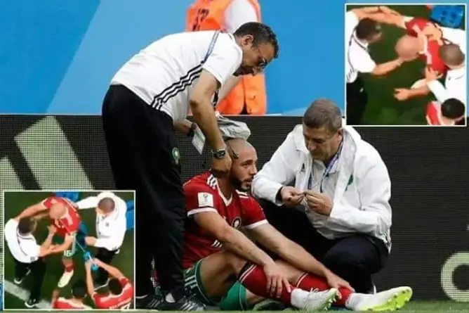 طبيب المنتخب يكشف طبيعة إصابة أمرابط ويؤكد غيابه لأسبوع