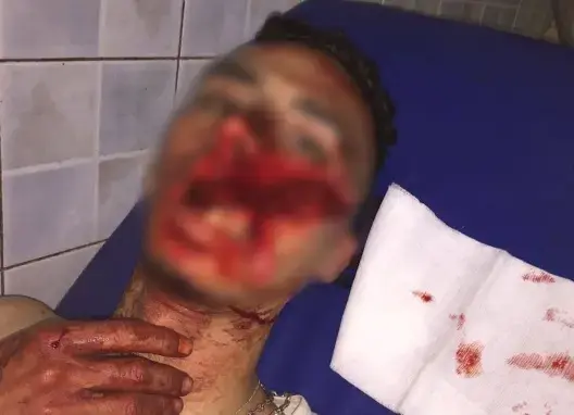 بشاعة .. عصابة “تفتح” وجه شاب بسيف في القليعة