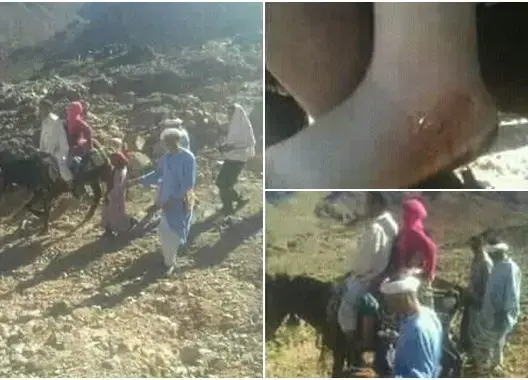 لدغتها أفعى ونُقلت على دابة.. حامل من زاكورة تواجه الموت بمراكش