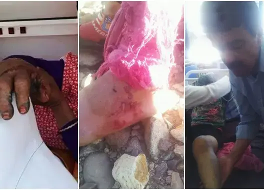 الأفاعي تضرب الجنوب.. وفاة سيدة بـ”تيشكا” وإصابة طفلة بـ”صاغرو” (صور)