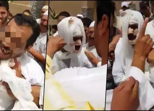 مُصلون بهُوارة يُحاصرون متسولاً لفّ وَجهه بضمادات ويكشفون خُدعته