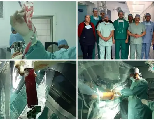 لأول مرة بمراكش.. فريق طبي يجري أول عملية علاج بالخلايا الجذعية (صور)