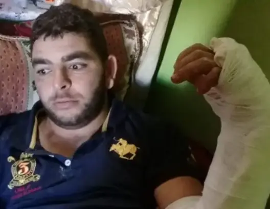 بائع قطاني بصفرو: شخص حاول ذبحي فقطع لي يدي بسبب 5 دراهم