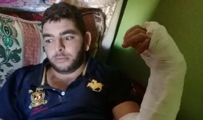 بائع قطاني بصفرو: شخص حاول ذبحي فقطع لي يدي بسبب 5 دراهم