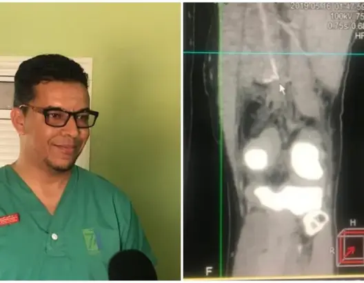 طبيب يكشف لـ”العمق” تفاصيل عملية جراحية أنقذت طفلا من بتر فخذه