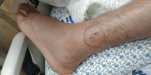بعد رحلة علاج فاشلة..أفعى سامة تقتل طفلا بأيت بها