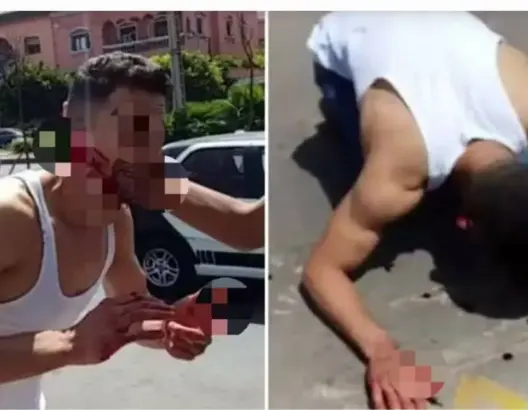 شخص “يمزق” وجه شاب بالبيضاء .. وأفراد الأمن يتعقبون المتورط (صور)