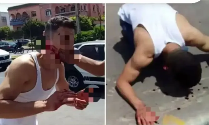 شخص “يمزق” وجه شاب بالبيضاء .. وأفراد الأمن يتعقبون المتورط (صور)