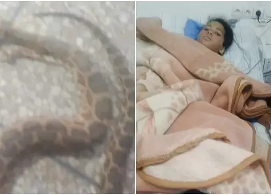 بعد تعرضها لِلَدغة أفعى .. “الصحة” تكشف حالة الطفلة خديجة بتنغير