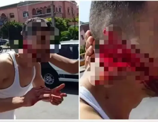 الأمن يتمكن من اعتقال المتورط في “تمزيق” وجه شاب بالبيضاء (صور)