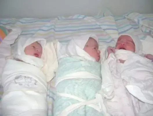 سيدة تضع 3 توائم ببني ملال بإشراف طاقم طبي