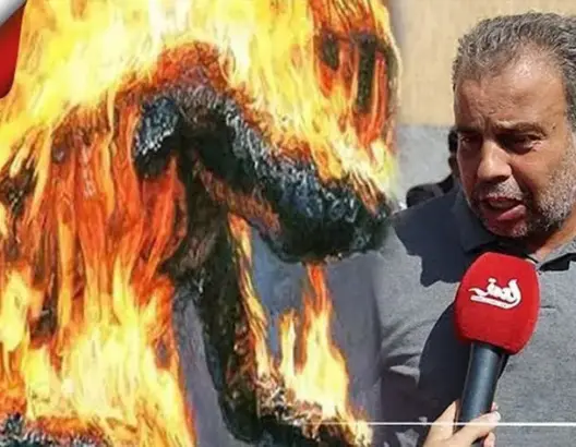 تفاصيل حرق متدرب نفسه