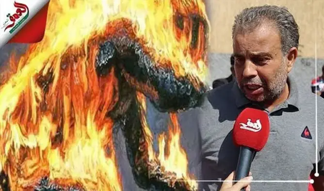 تفاصيل حرق متدرب نفسه