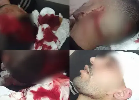 بـ40 غرزة.. مسلح يرسل موظفا بسجن عين السبع إلى المستشفى