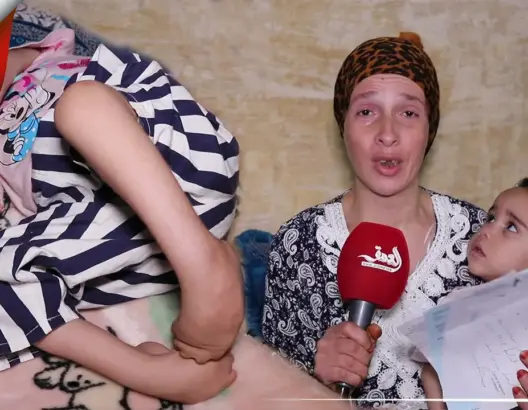 كوثر.. طفلة بالحاجب حول الفقر ومرض نادر حياتها إلى جحيم (فيديو)