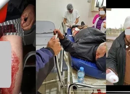 طعنات سكين غادرة ترسل مراقب وسائق حافلة إلى مشفى فاس (صور)