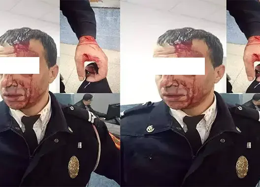 فيديو يهز الرأي العام.. شخص يعتدي على شرطي ويصيبه بجروح بليغة