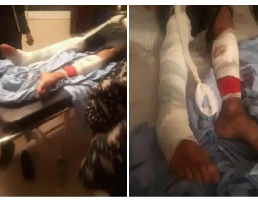 طالب “زاكوري” بين الحياة والموت بمشفى أكادير .. والأمن يفتح تحقيقا