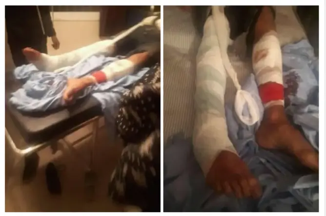 طالب “زاكوري” بين الحياة والموت بمشفى أكادير .. والأمن يفتح تحقيقا