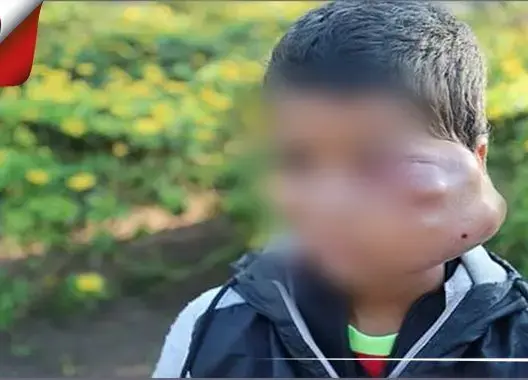 مروان .. طفل يصارع السرطان ووالده يناشد المسؤولين لإنقاذ حياته (فيديو)
