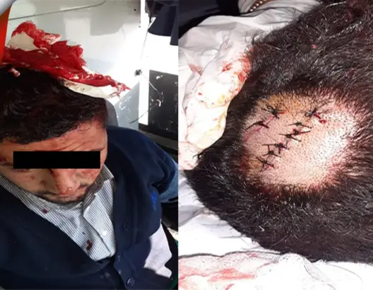 نقل سائق حافلة بالجديدة إلى المستشفى إثر تعرضه لاعتداء بالسلاح الأبيض (صور)