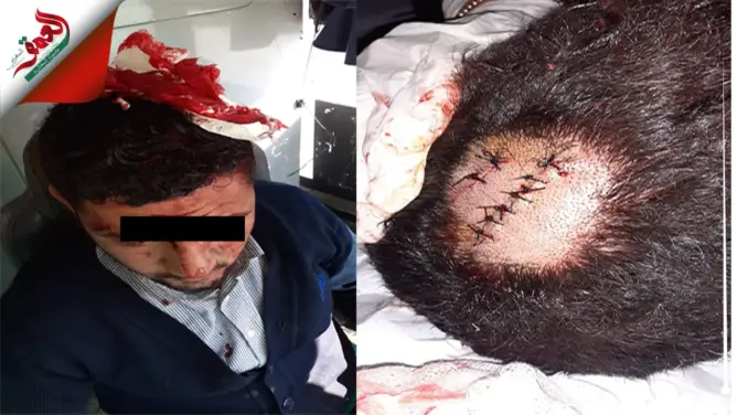 نقل سائق حافلة بالجديدة إلى المستشفى إثر تعرضه لاعتداء بالسلاح الأبيض (صور)