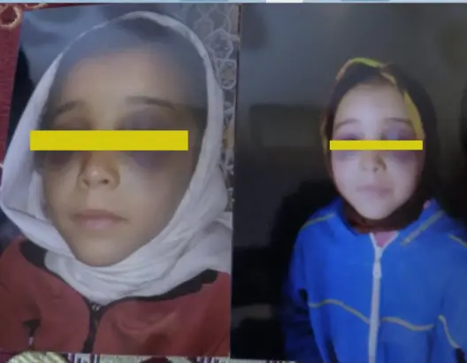 إحالة مريم ضحية التعنيف على طبيب مختص .. ومساع للصلح