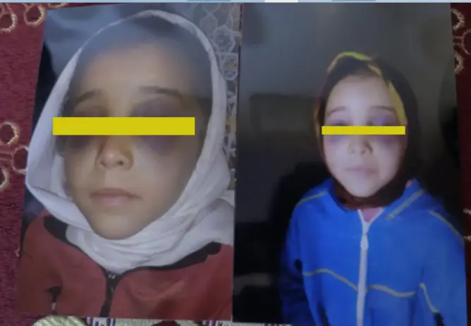 إحالة مريم ضحية التعنيف على طبيب مختص .. ومساع للصلح
